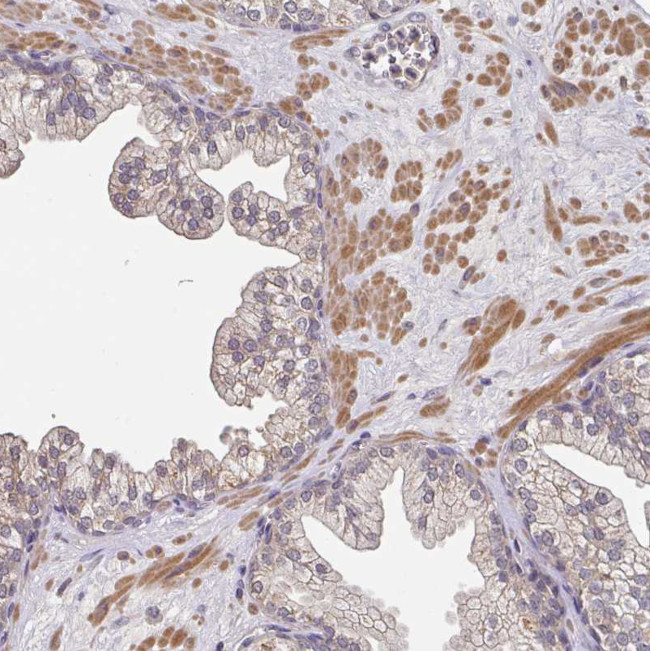 ACVR2B Antibody in Immunohistochemistry (Paraffin) (IHC (P))