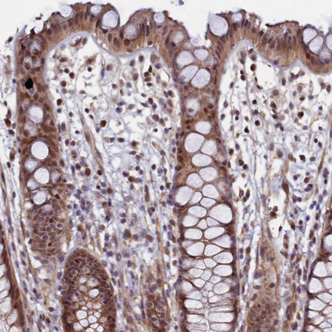 LEO1 Antibody in Immunohistochemistry (Paraffin) (IHC (P))