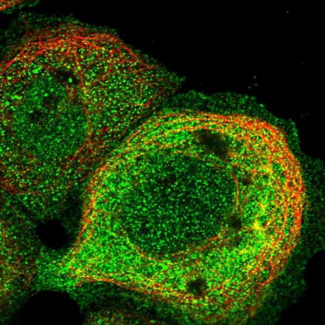 TRPM4 Antibody in Immunocytochemistry (ICC/IF)