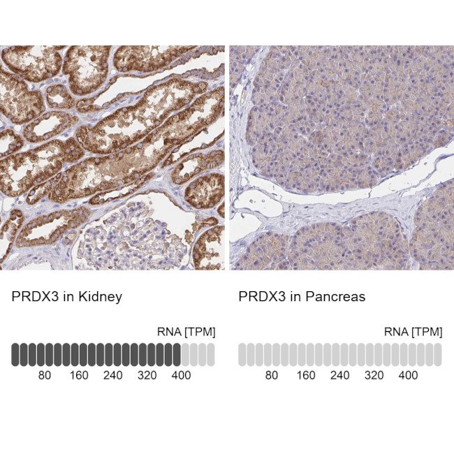 PRDX3 Antibody in Immunohistochemistry (Paraffin) (IHC (P))