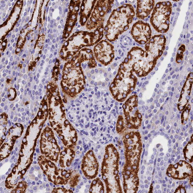 ABAT Antibody in Immunohistochemistry (Paraffin) (IHC (P))