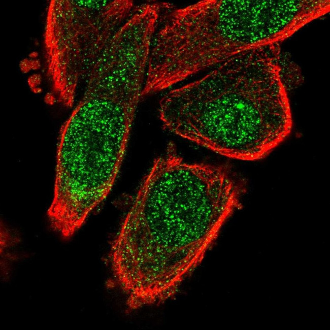 MED10 Antibody in Immunocytochemistry (ICC/IF)