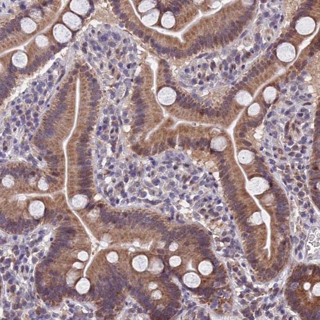 CYP2R1 Antibody in Immunohistochemistry (Paraffin) (IHC (P))