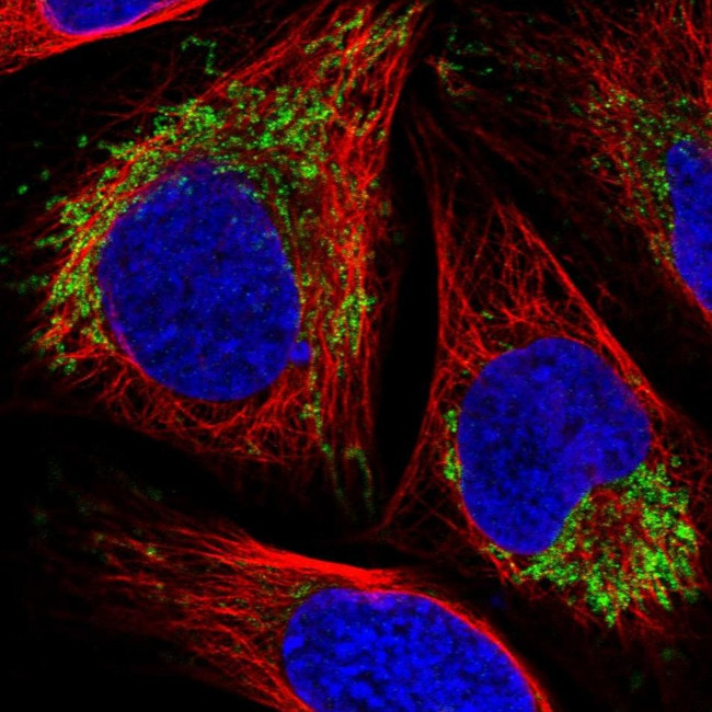 VDAC2 Antibody in Immunocytochemistry (ICC/IF)