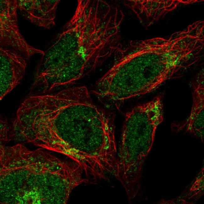 IL17RD Antibody in Immunocytochemistry (ICC/IF)