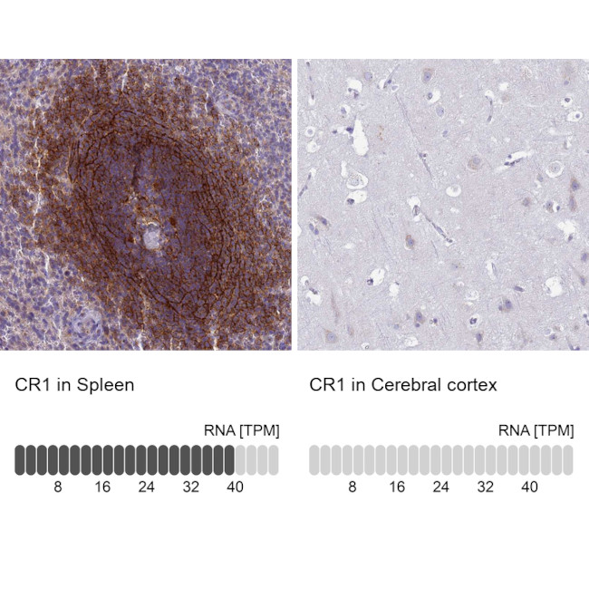 CD35 Antibody in Immunohistochemistry (Paraffin) (IHC (P))