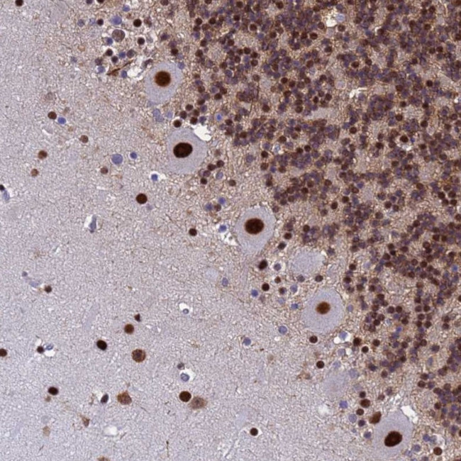 SART3 Antibody in Immunohistochemistry (Paraffin) (IHC (P))