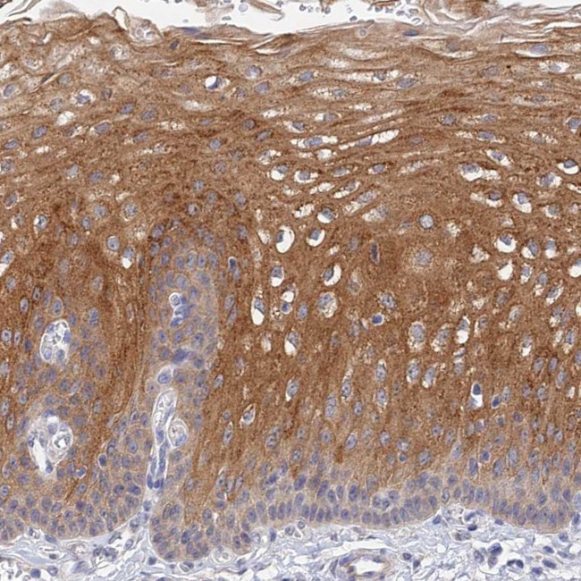 HOXB1 Antibody in Immunohistochemistry (Paraffin) (IHC (P))