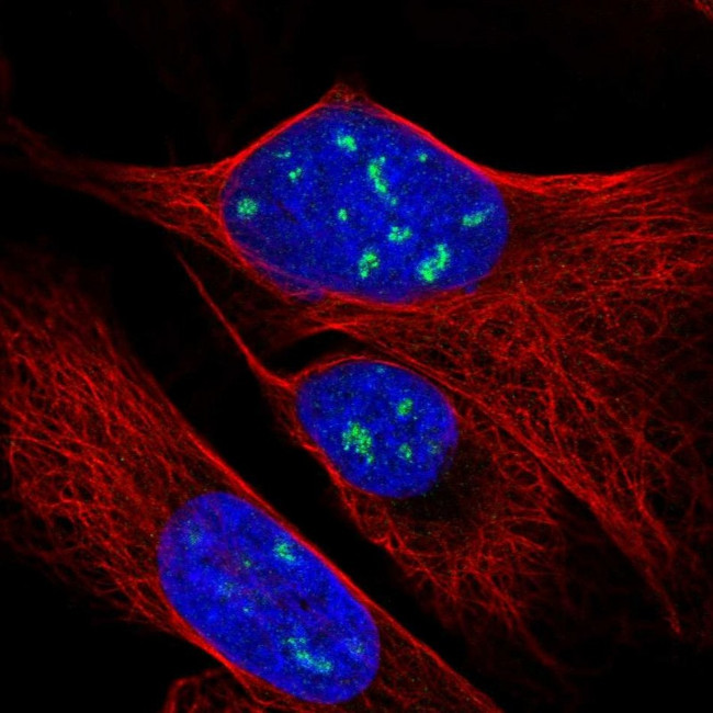 RPP38 Antibody in Immunocytochemistry (ICC/IF)