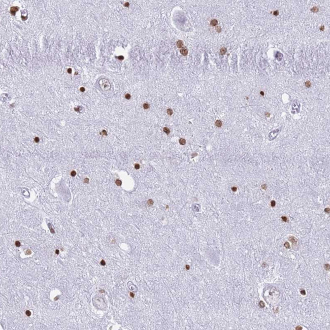 RYK Antibody in Immunohistochemistry (Paraffin) (IHC (P))