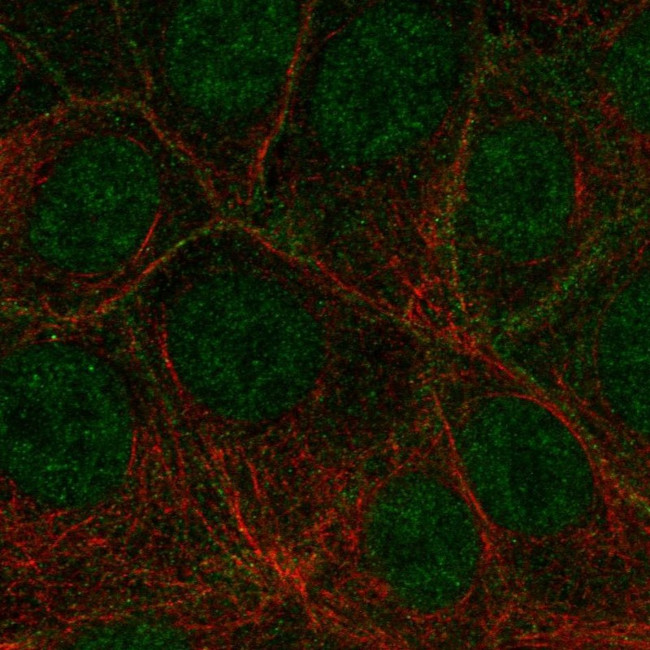 VEGF Receptor 3 Antibody in Immunocytochemistry (ICC/IF)