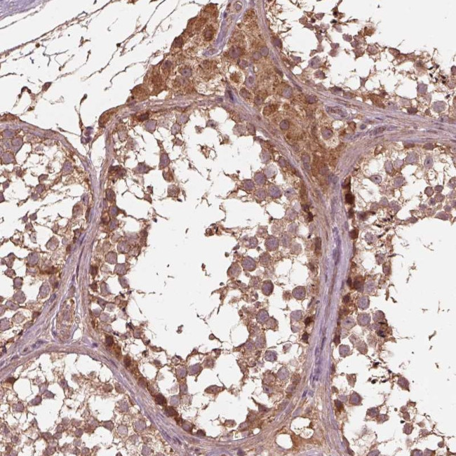 METTL4 Antibody in Immunohistochemistry (Paraffin) (IHC (P))