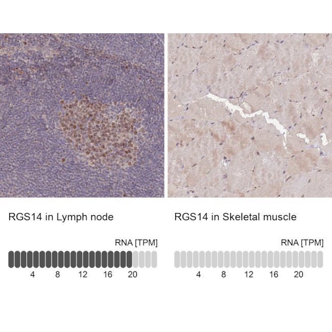 RGS14 Antibody in Immunohistochemistry (Paraffin) (IHC (P))