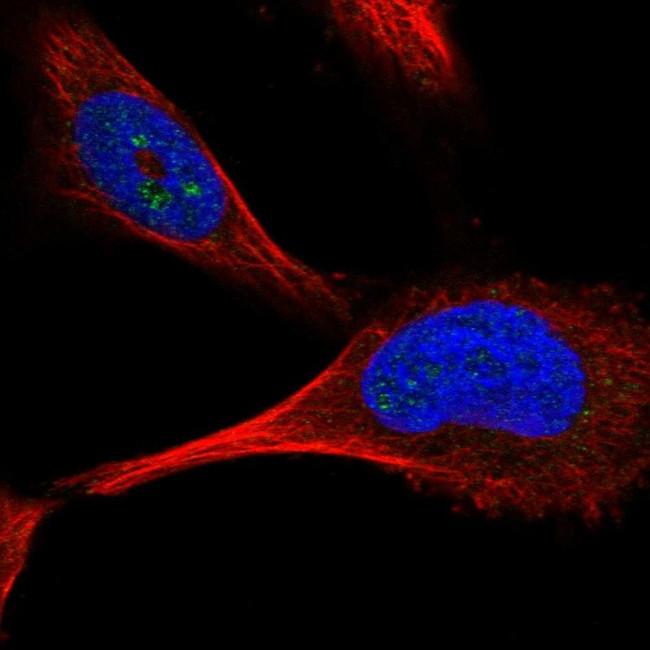 PFKFB4 Antibody in Immunocytochemistry (ICC/IF)