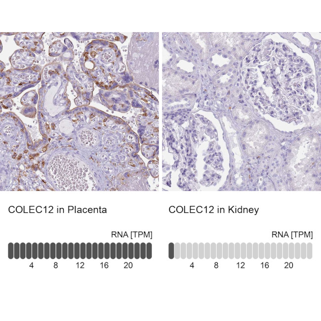 COLEC12 Antibody in Immunohistochemistry (Paraffin) (IHC (P))