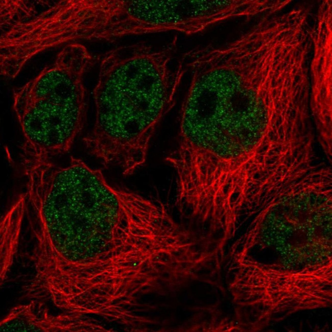 Vinexin Antibody in Immunocytochemistry (ICC/IF)