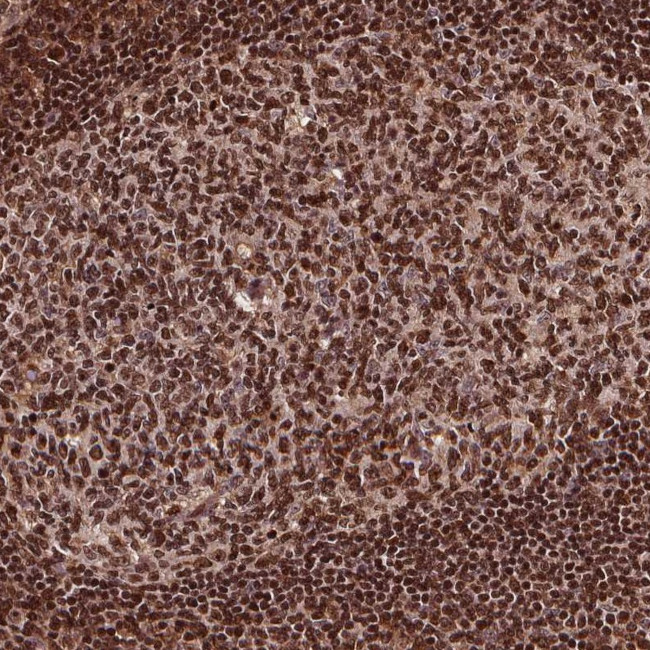 PMSCL1 Antibody in Immunohistochemistry (Paraffin) (IHC (P))