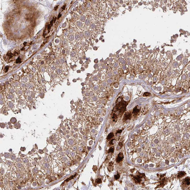 GNS Antibody in Immunohistochemistry (Paraffin) (IHC (P))