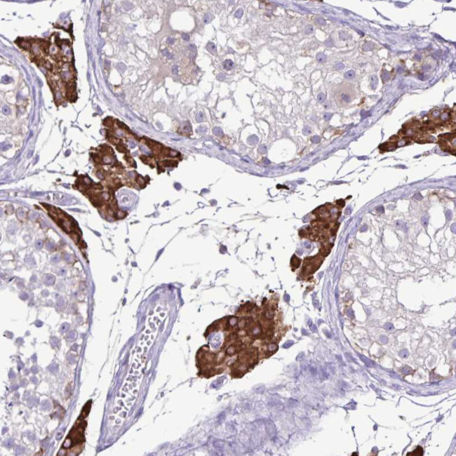 CYP17A1 Antibody in Immunohistochemistry (Paraffin) (IHC (P))