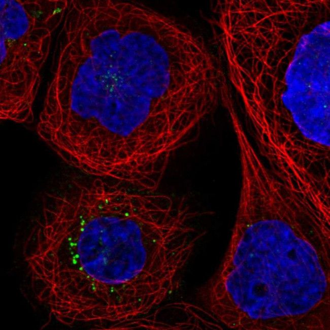 CD142 Antibody in Immunocytochemistry (ICC/IF)