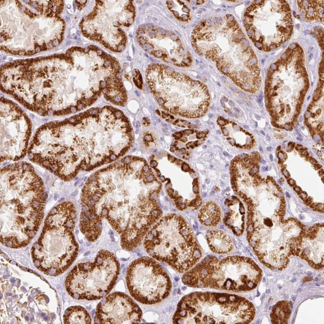 MTHFD2 Antibody in Immunohistochemistry (Paraffin) (IHC (P))