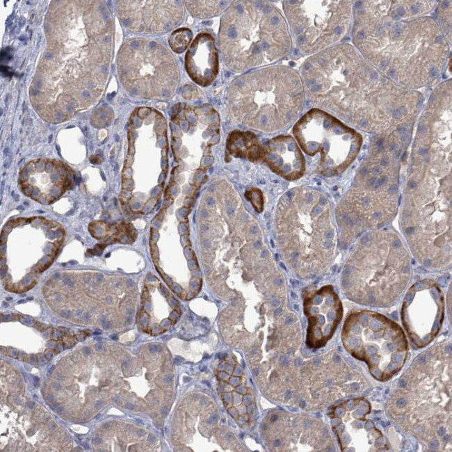 K-Ras Antibody in Immunohistochemistry (Paraffin) (IHC (P))