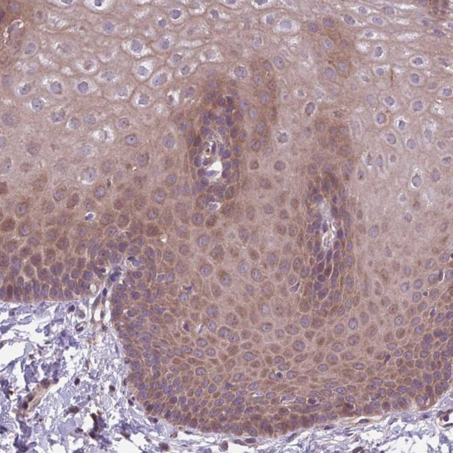 ITPKC Antibody in Immunohistochemistry (Paraffin) (IHC (P))