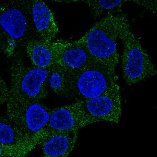 Coronin 1A Antibody in Immunocytochemistry (ICC/IF)