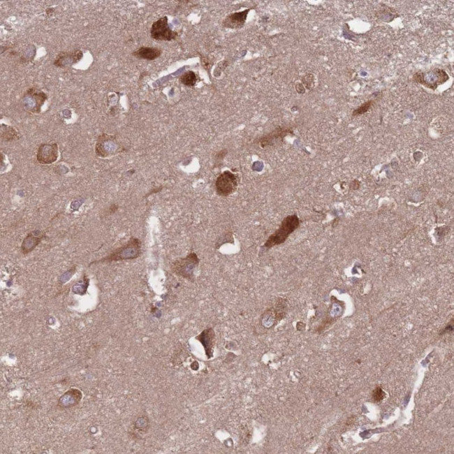 GABRB1 Antibody in Immunohistochemistry (Paraffin) (IHC (P))