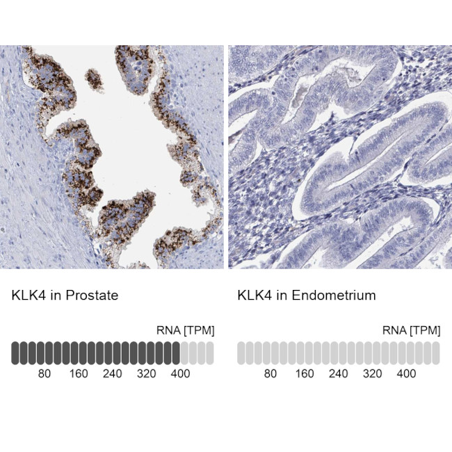 Kallikrein 4 Antibody in Immunohistochemistry (Paraffin) (IHC (P))