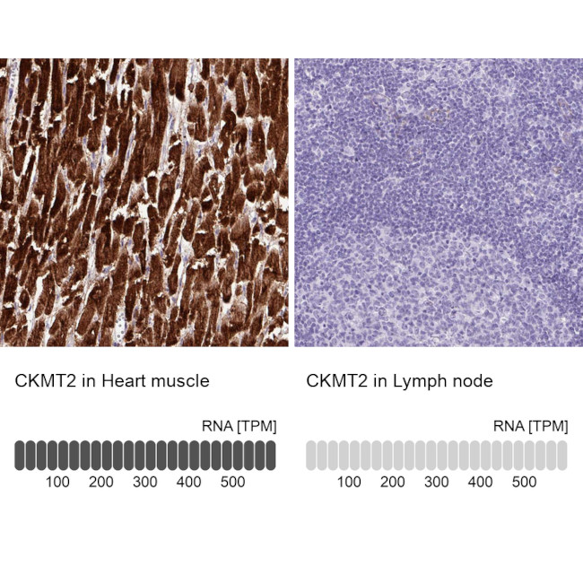 CKMT2 Antibody in Immunohistochemistry (Paraffin) (IHC (P))