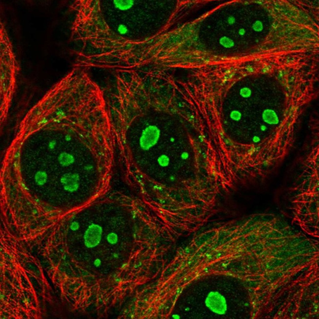 PARP10 Antibody in Immunocytochemistry (ICC/IF)