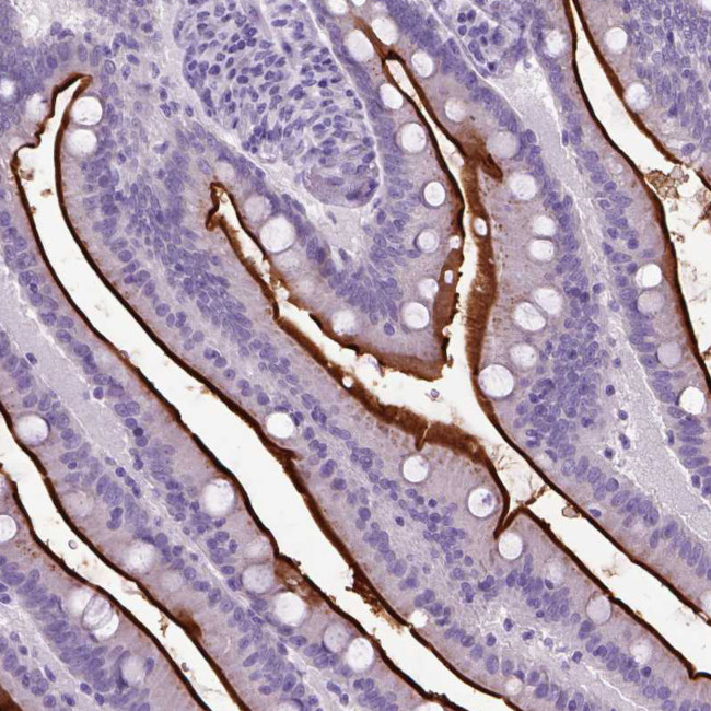 CD10 Antibody in Immunohistochemistry (Paraffin) (IHC (P))