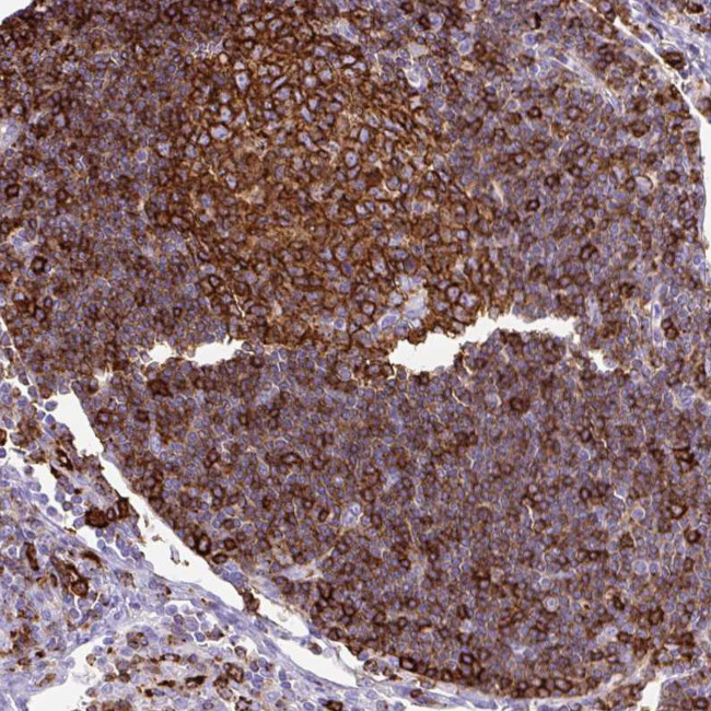 HLA-DRA Antibody in Immunohistochemistry (Paraffin) (IHC (P))