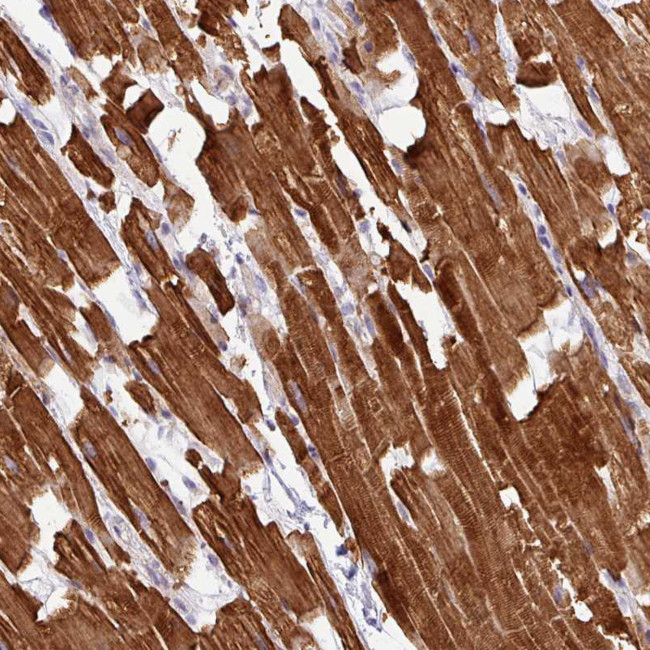 HBEGF Antibody in Immunohistochemistry (Paraffin) (IHC (P))