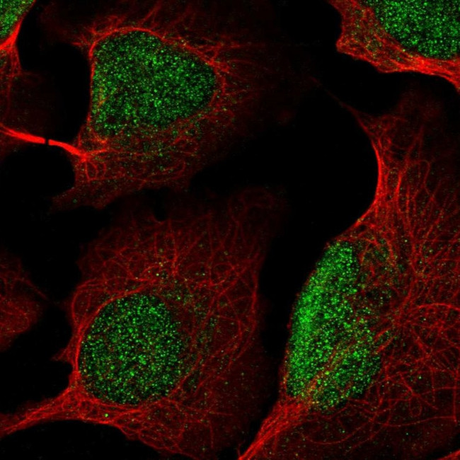 KDM5B Antibody in Immunocytochemistry (ICC/IF)