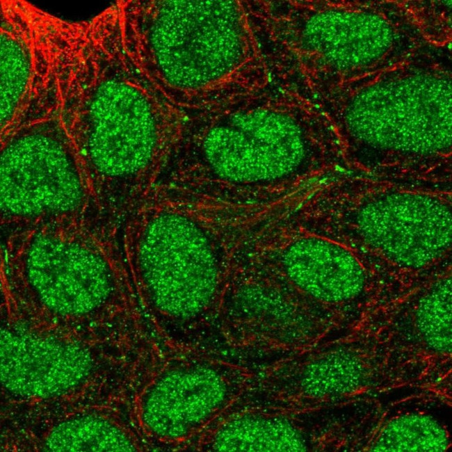 SEMA4A Antibody in Immunocytochemistry (ICC/IF)