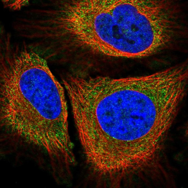 PLA2G4A Antibody in Immunocytochemistry (ICC/IF)