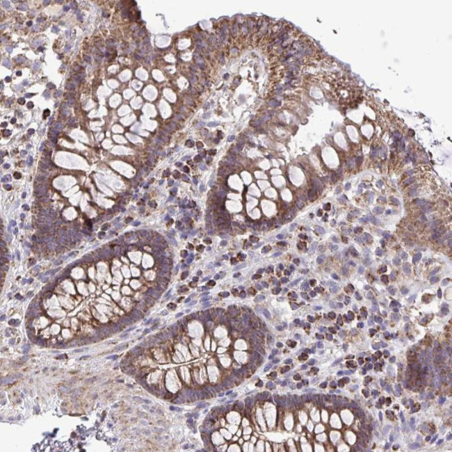 ATP13A2 Antibody in Immunohistochemistry (Paraffin) (IHC (P))