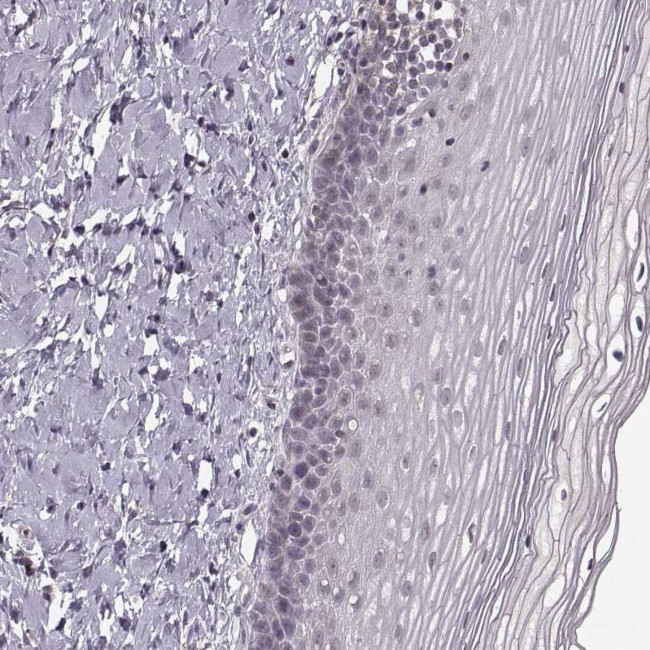 ASIC3 Antibody in Immunohistochemistry (Paraffin) (IHC (P))