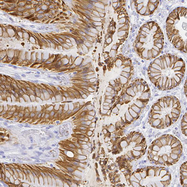 SMURF1 Antibody in Immunohistochemistry (Paraffin) (IHC (P))