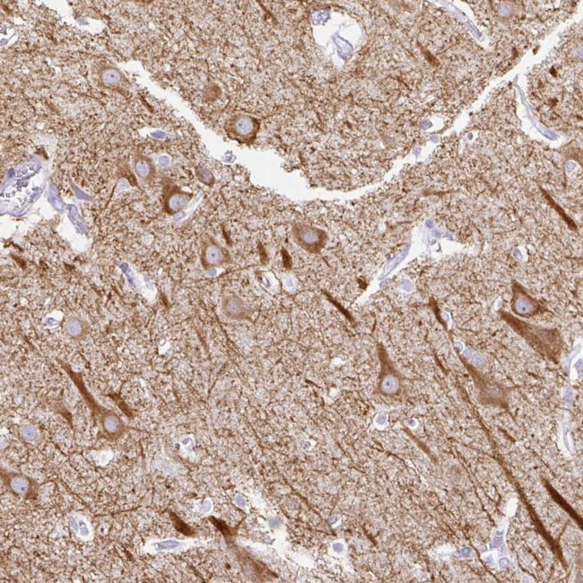 HEY1 Antibody in Immunohistochemistry (Paraffin) (IHC (P))