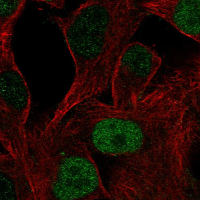 OCT6 Antibody in Immunocytochemistry (ICC/IF)