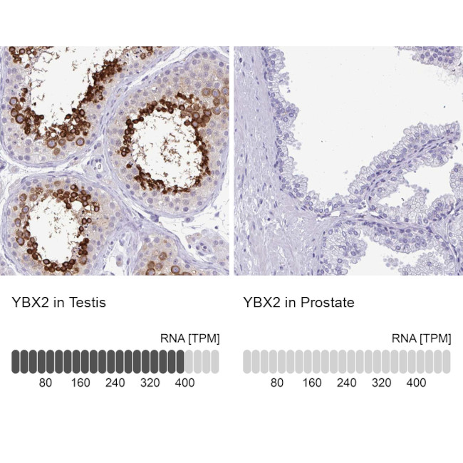 YBX2 Antibody in Immunohistochemistry (Paraffin) (IHC (P))