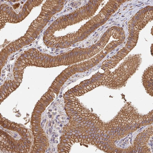 POLG Antibody in Immunohistochemistry (Paraffin) (IHC (P))