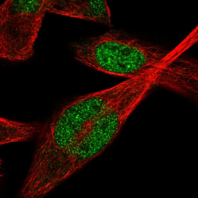 IPMK Antibody in Immunocytochemistry (ICC/IF)