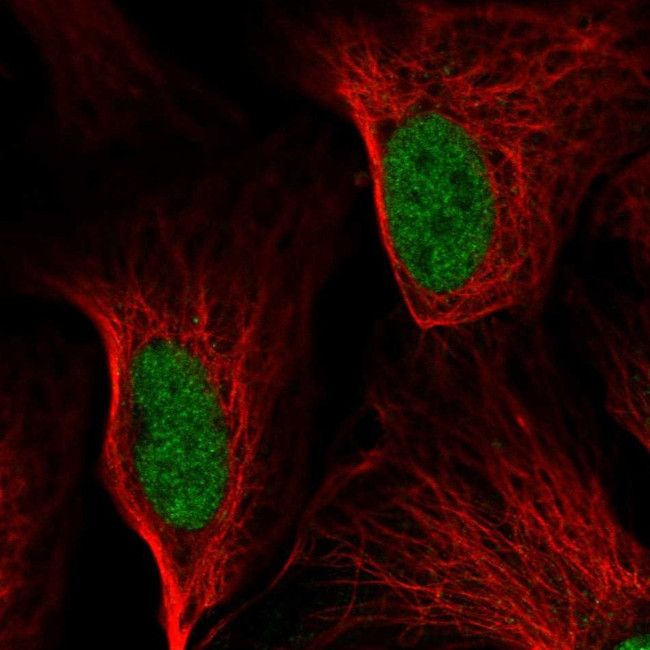 CHOP Antibody in Immunocytochemistry (ICC/IF)