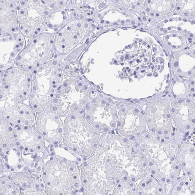 RUNX3 Antibody in Immunohistochemistry (Paraffin) (IHC (P))