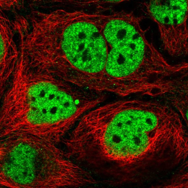 N4BP2L2 Antibody in Immunocytochemistry (ICC/IF)