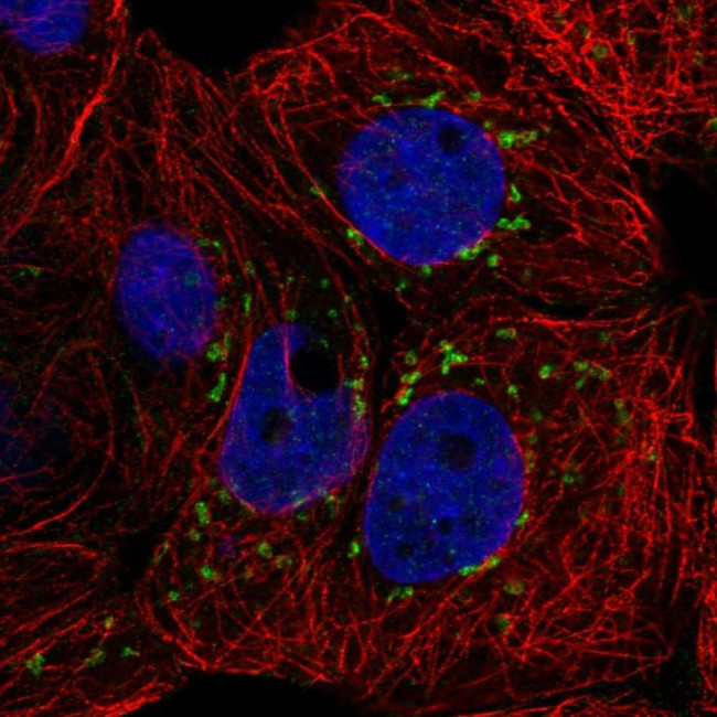 CACNB3 Antibody in Immunocytochemistry (ICC/IF)